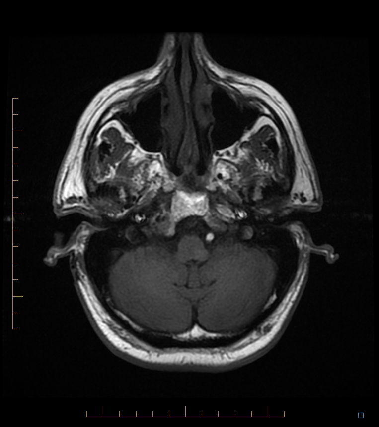 Radiology Cases November 2011