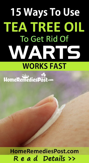 15 Effective Ways To Apply Tea Tree Oil To Warts Tea-Tree-Oil-For-Warts, Tea Tree Oil And Warts, How To Get Rid Of Warts, How To Remove Warts, Wart Treatment, Home Remedies For Warts, Causes Of Warts, How To Treat Warts, Remedy For Warts,
