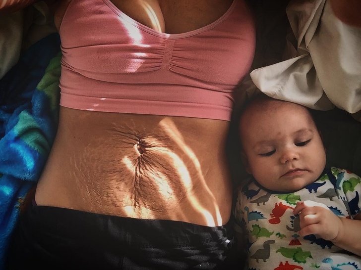 25 Women Shared Their Powerful Postpartum Pictures