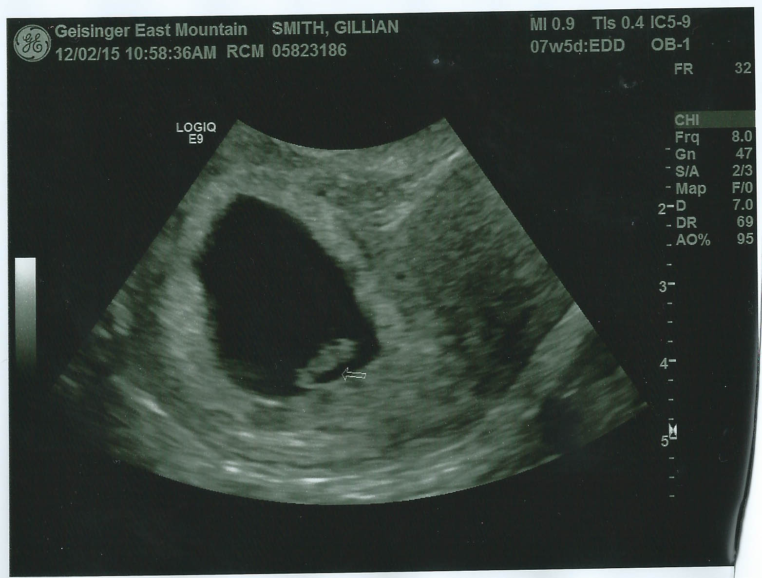 Is a dating ultrasound necessary