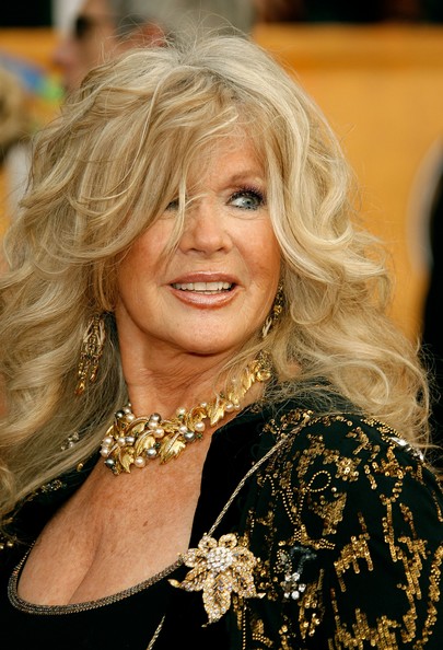 Connie Stevens Plastic Surgery Before And After Botox Injections And