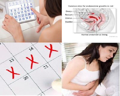 Menstruasi Tidak Lancar Gejala Awal Penyakit Ginekologi
