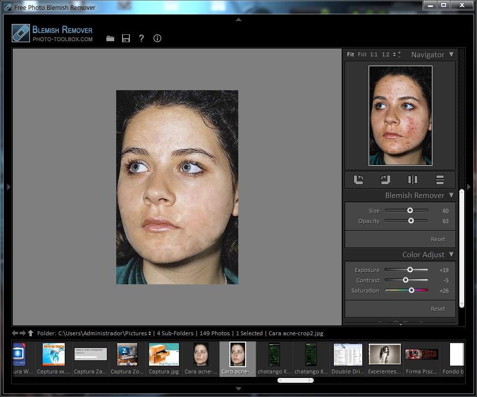 Free Photo Blemish Remover v2.0.1 [Corrige imperfecciones como acné o