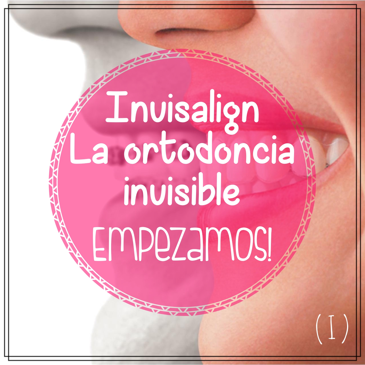 Mi Cuaderno De Notas Invisalign La Ortodoncia Invisible Empezamos I la ortodoncia invisible empezamos i