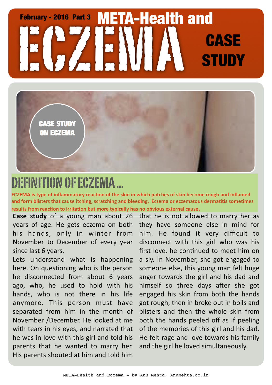 Case study on eczema and METAHealth written by anu Mehta Dr Anu Mehta
