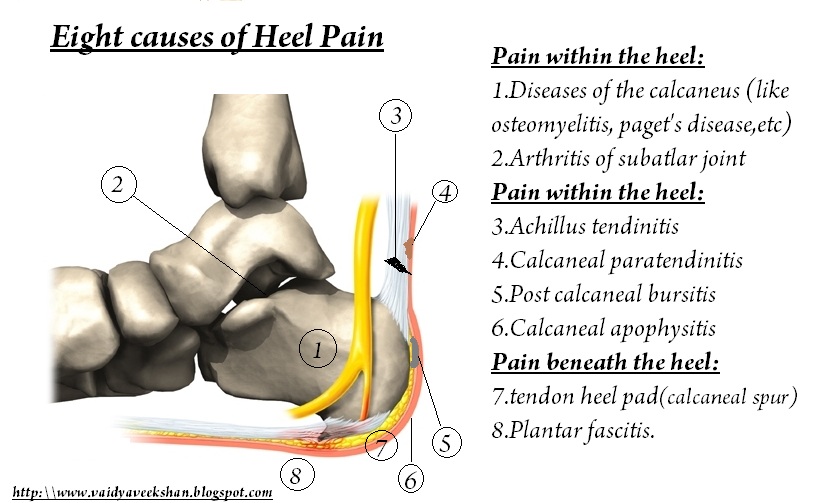 Diagnose: Diagnose Heel Pain