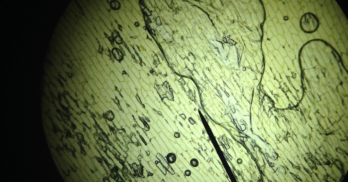 The Cinnamon Note Under The Microscope