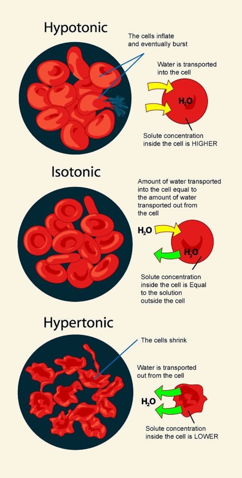 Medical and Health Science: Hypotonic, Isotonic, Hypertonic Solution
