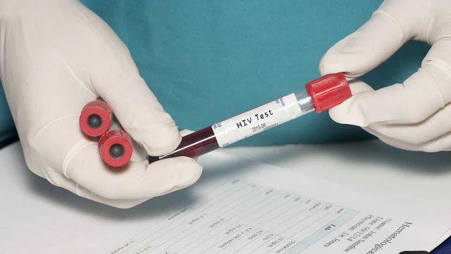 Cientistas detectam segundo caso de remissão total do HIV