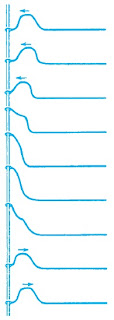 Refleksi sebuah pulsa di ujung bebas sebuah tali yang direnggangkan
