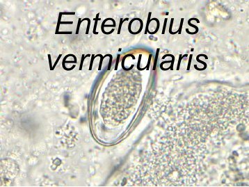 enterobius vermicularis tedavi