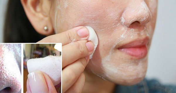 How To Remove Blackheads At Home! A Simple Trick!