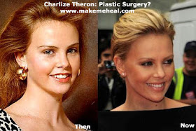 Stars Plastic Surgery Before And After Charlize Theron Plastic Surgery
