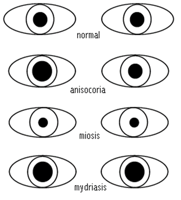 Head and Eye assessment