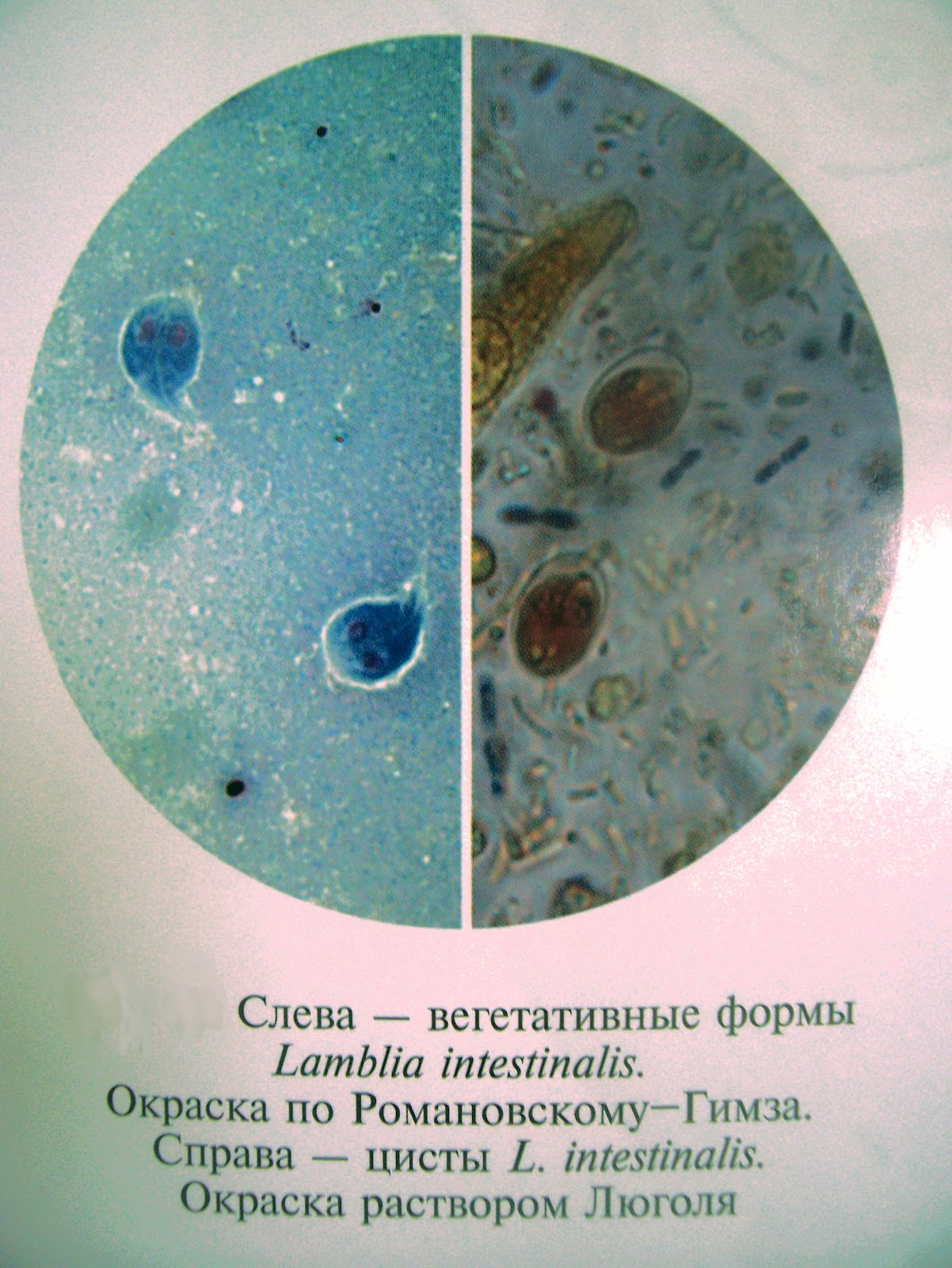 Признаки лямблиоза у детей | Наши дети - Советы родителям ...
