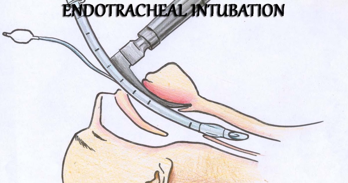 Nawalparasi Helth Worker Endotracheal Intubation