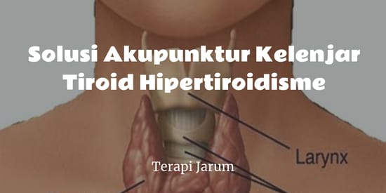 Solusi Akupunktur Kelenjar Tiroid Hipertiroidisme Terapi Jarum Solusi Akupunktur Kelenjar Tiroid Hipertiroidisme Terapi Jarum