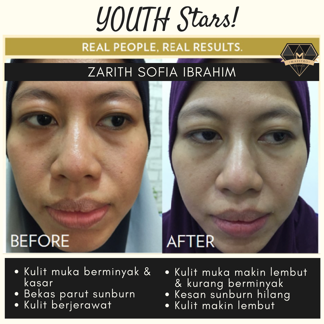 pencuci muka kulit berminyak pencuci muka kulit berminyak