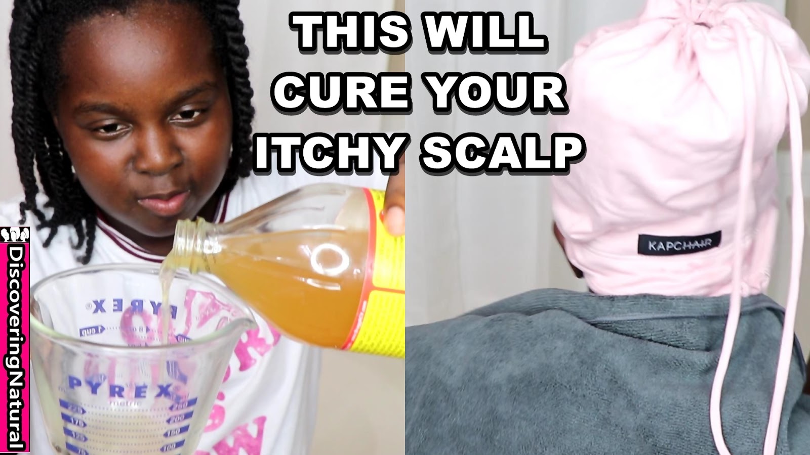 Apple Cider Vinegar For Itchy Scalp All You Need Infos