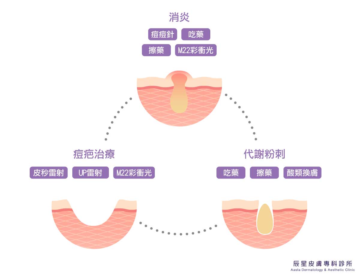 【M22彩衝光】正在發炎的痘痘該怎麼辦?口碑好評痘痘肌救星–M22彩衝光