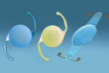 Cristalino Artificial: Lente Intraocular: 1. Monofocal. 2. Multifocal. 3. Acomodativa