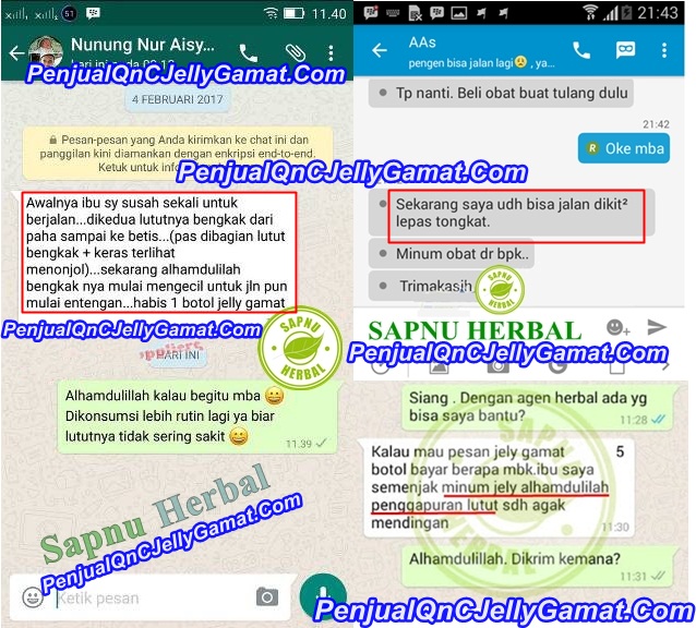 Cara Mengobati Kaki Bengkak Karena Luka Secara Alami Sampai Tuntas Cara Mengobati Kaki Bengkak Karena Luka Secara Alami Sampai Tuntas