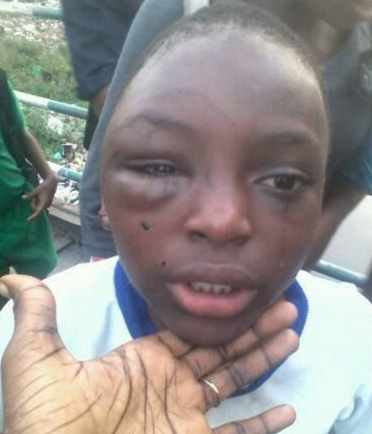 girl tortured by father mile 12 lagos