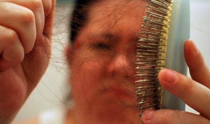 Cara Merawat Rambut Ketombe Dan Rontok Cara Merawat Rambut Ketombe Dan Rontok