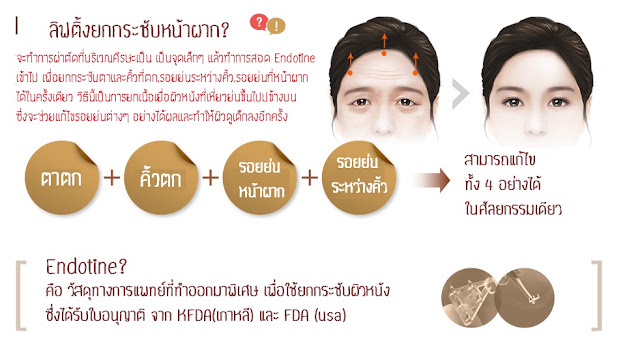 surgery_methods_eye_endotine_01.jpg