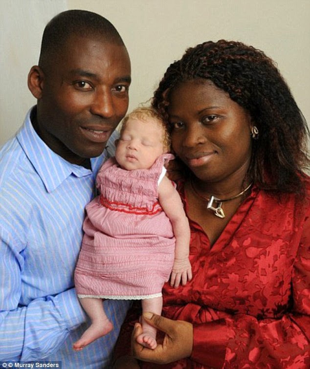 Shock as Black Nigerian woman gives birth to white baby (Photos) .