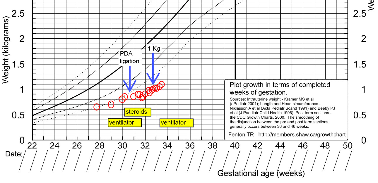 IUGR baby November 2011