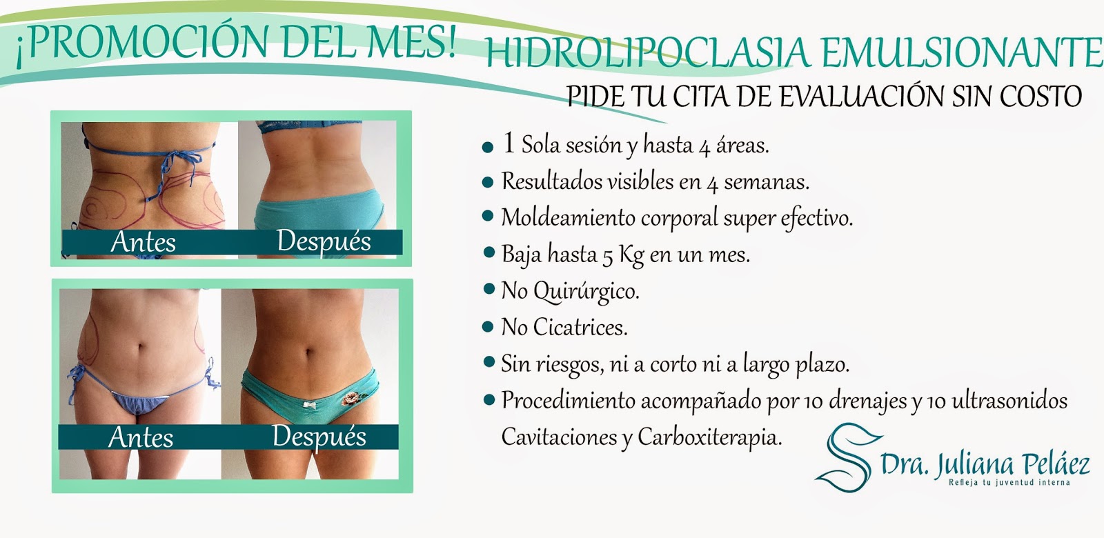 hidrolipoclasia efectos secundarios