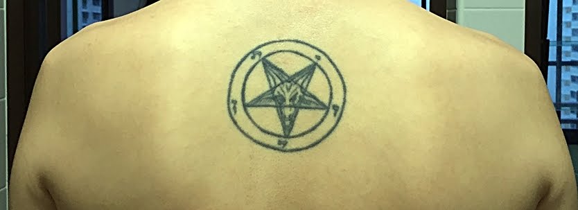 My Laser Tattoo Removal Journey And Experience