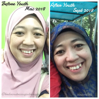 Testimoni Youth SKincare