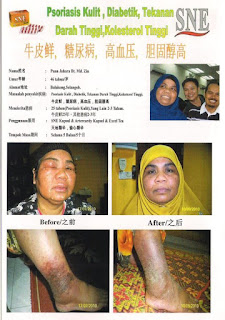 Ubat Darah Tinggi Dan Kolesterol  Makanan Terbaik Bagi Darah Tinggi