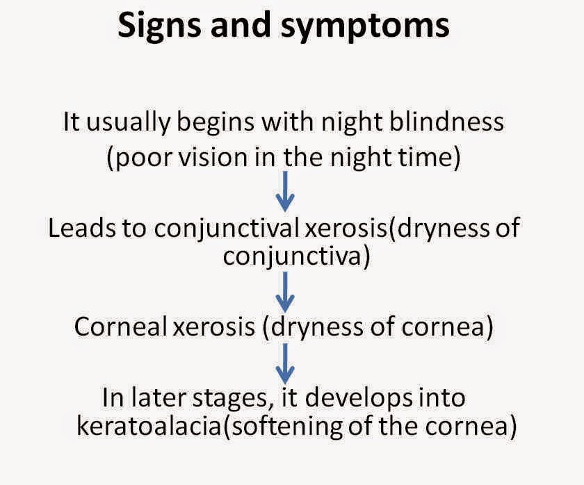 My Teaching Experiences Xerophthalmia
