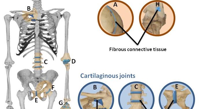 Iwona Physio: Painful joints, something about Osteoarthritis and ...