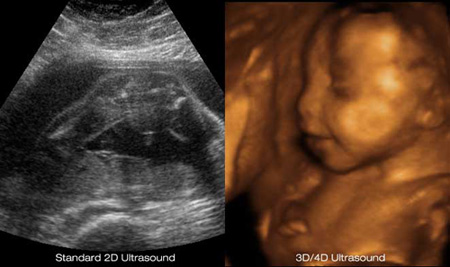 Information of Pregnancy Ultrasound Week-by-Week
