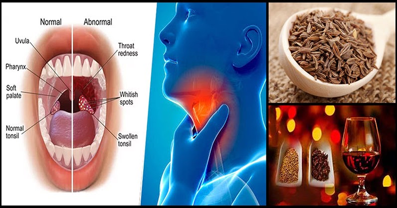 Glands remedies throat for swollen 10 Home