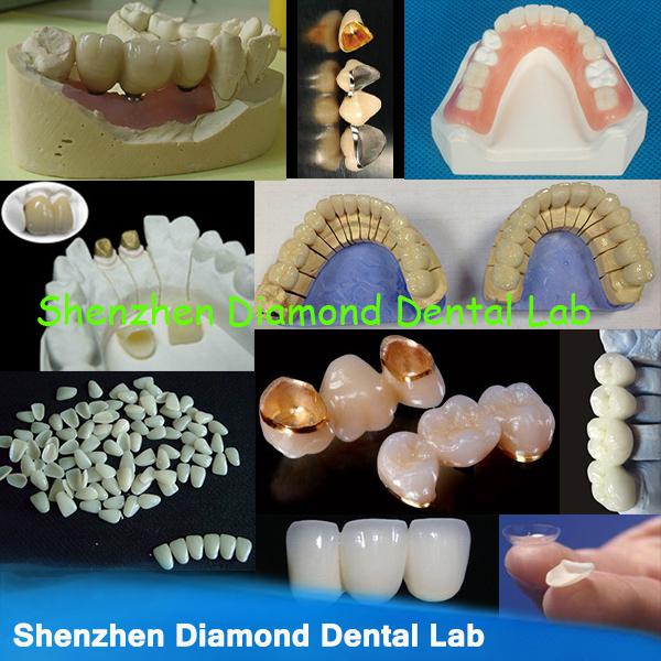 Dental Implant Supply Customised Dental CoCr Implants Crown Dental False teeth