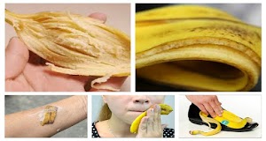 Les meilleurs utilisations étonnantes de la peau de banane
