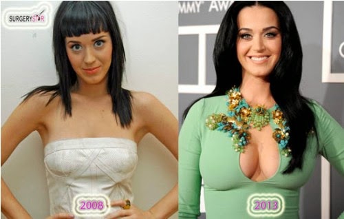 Famous For Plastic Surgery Has Katy Perry Had Plastic Surgery Breast Implan...