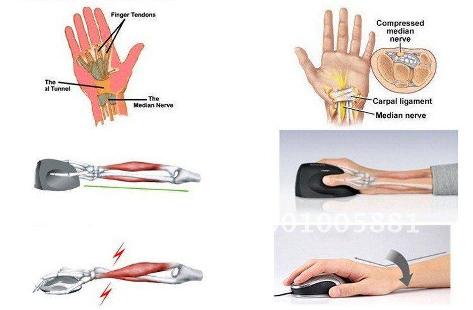 Ergonomic Mouse & Ergonomic Keyboard Ergonomic mouse ราคาถูก