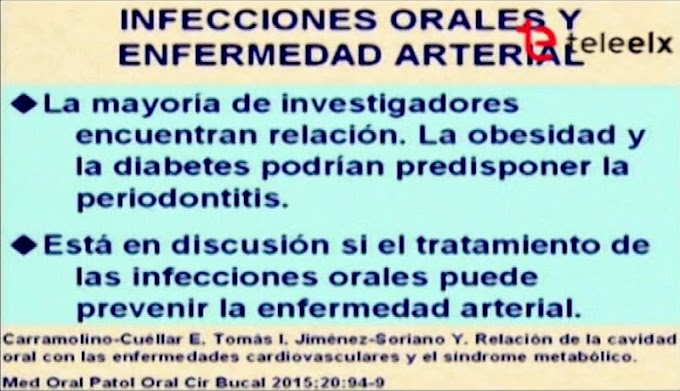 ENTREVISTA: Infecciones Bucales y Enfermedad del Corazón - Dr. Ambrosio Bermejo