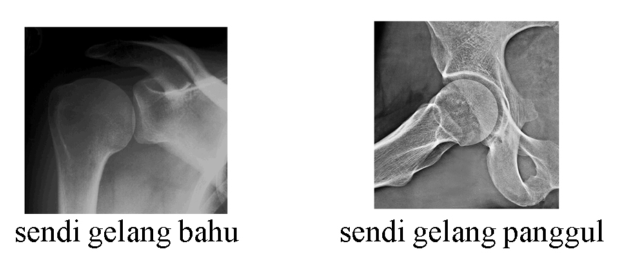 Macam-Macam Sendi Pada Manusia dan Gambar Letaknya - Biologizone