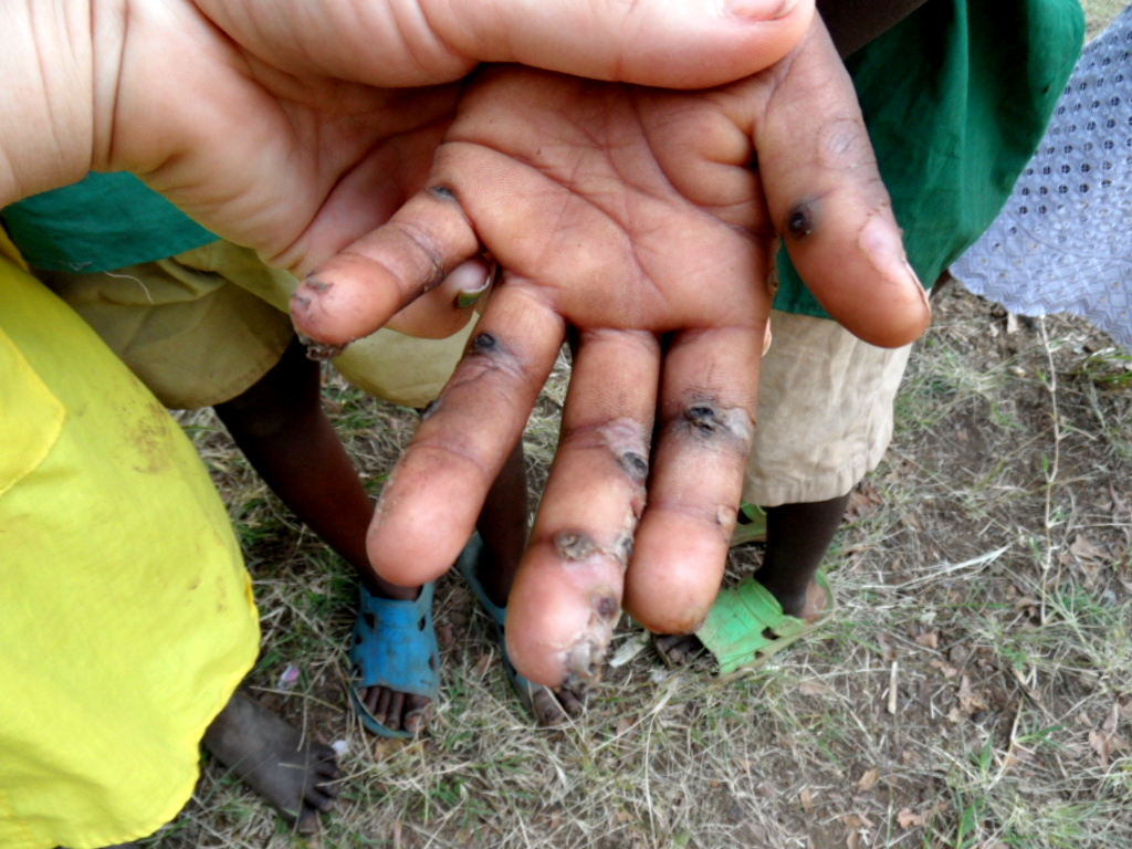 The Journey is the Reward Dirt, Bugs, Bites and Beads