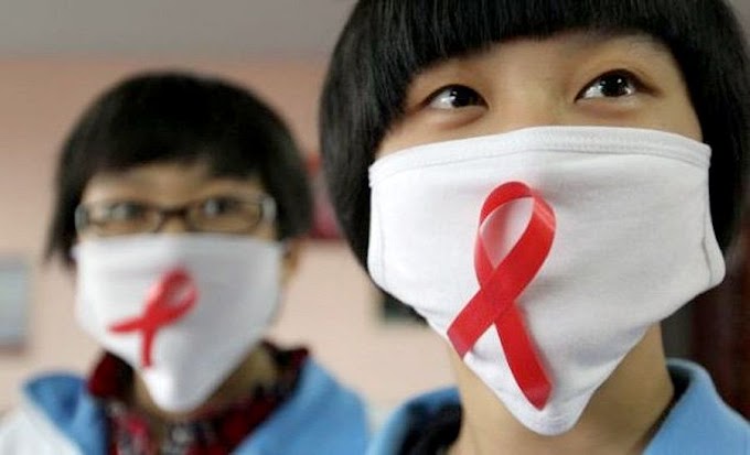 VIH/SIDA: La boca puede ser el primer indicador de la infección por el virus del sida