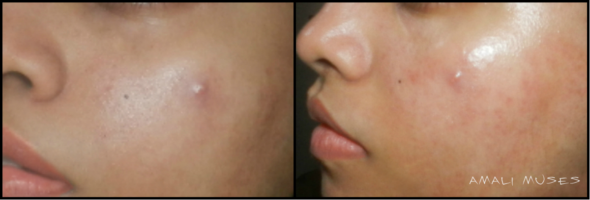 Download Amali Muse Aztec Secret Indian Healing Clay Review Before And Afters PSD Mockup Templates