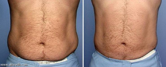 طريقة لتنحيف والتخلص من  الكرش فوراً فقط  في أقل من أسبوع  !!