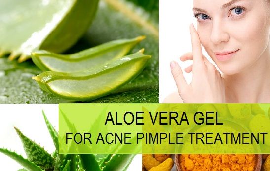 Aloe Vera for Acne and Acne Scars Treatment